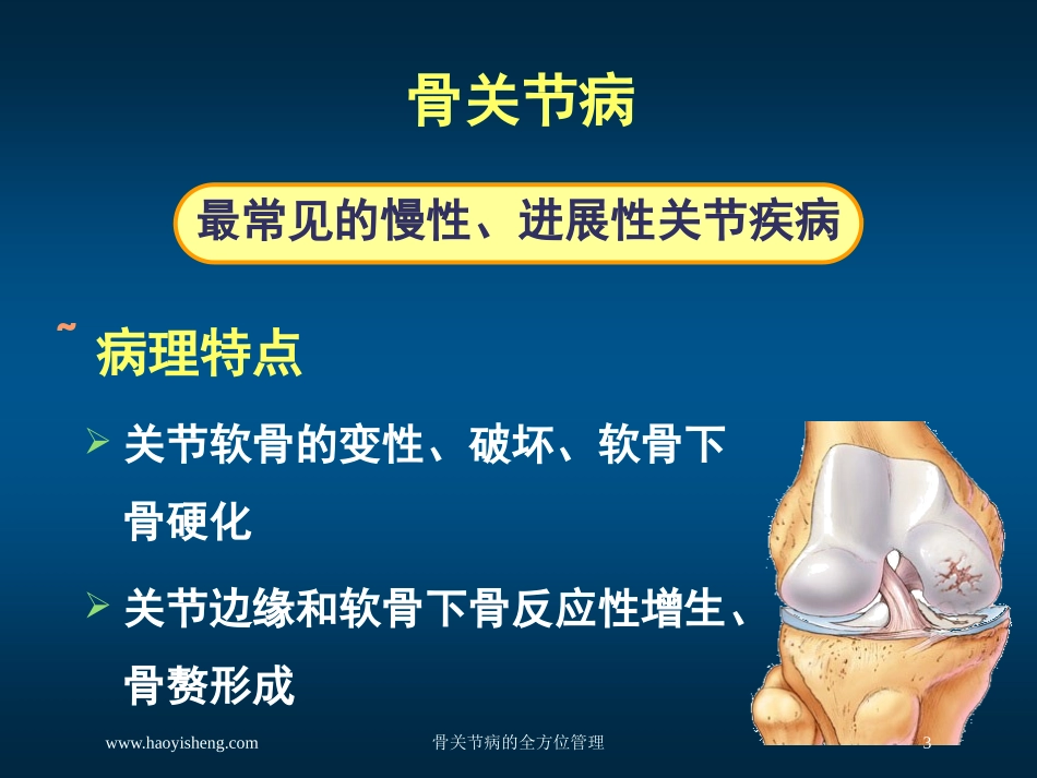 骨关节病的全方位管理培训课件.pptx_第3页