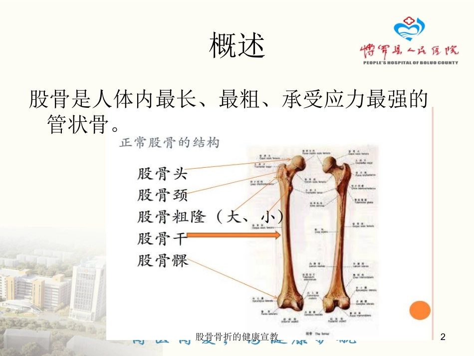股骨骨折的健康宣教培训课件.pptx_第2页
