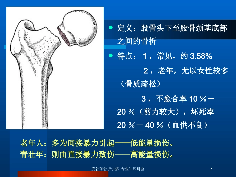股骨颈骨折讲解-专业知识讲座培训课件.pptx_第2页