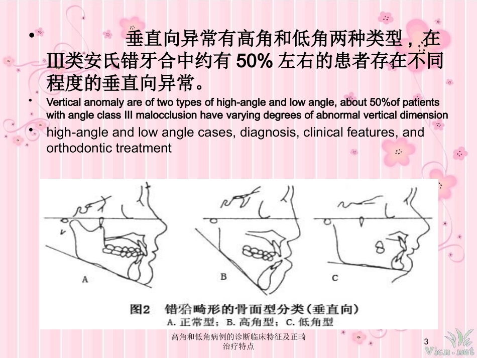 高角和低角病例的诊断临床特征及正畸治疗特点培训课件.pptx_第3页
