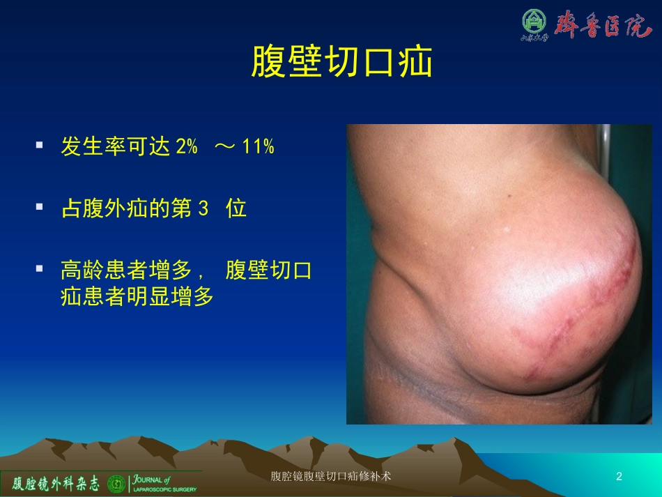 腹腔镜腹壁切口疝修补术培训课件.pptx_第2页