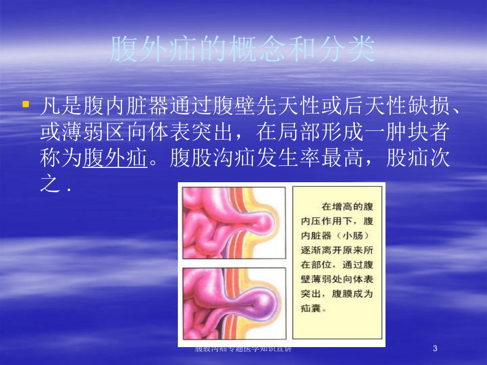 腹股沟疝专题医学知识宣讲培训课件.pptx_第3页
