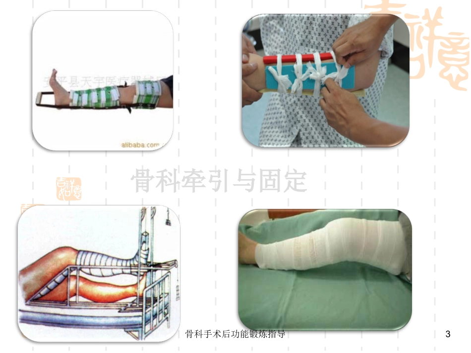 骨科手术后功能锻炼指导培训课件.pptx_第3页