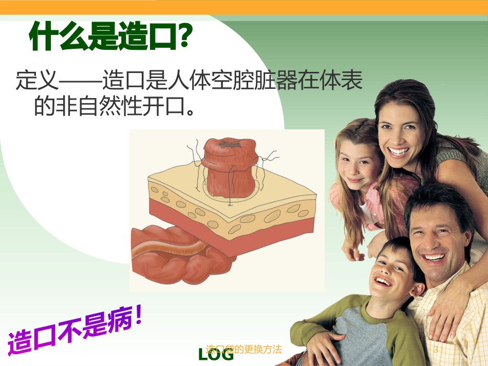 造口袋的更换方法培训课件.pptx_第3页