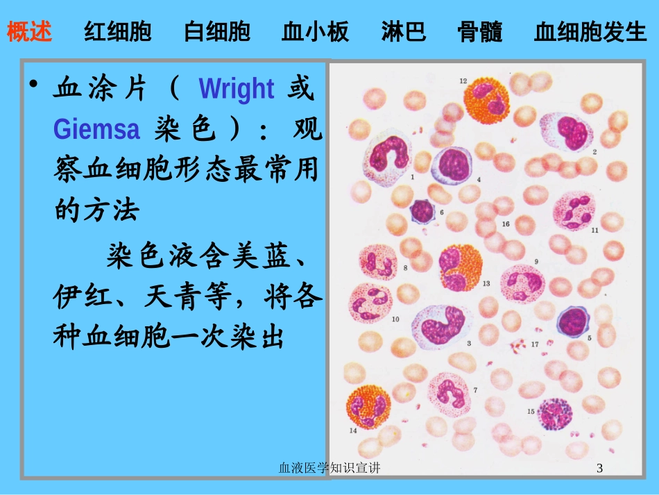 血液医学知识宣讲培训课件.pptx_第3页
