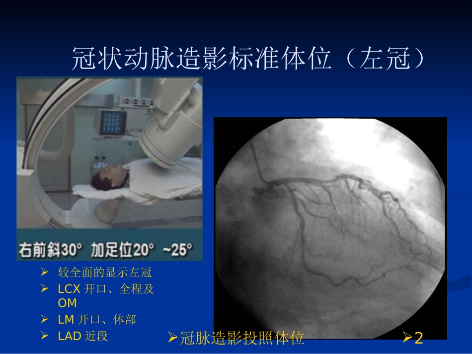 冠脉造影投照体位培训课件.pptx_第2页
