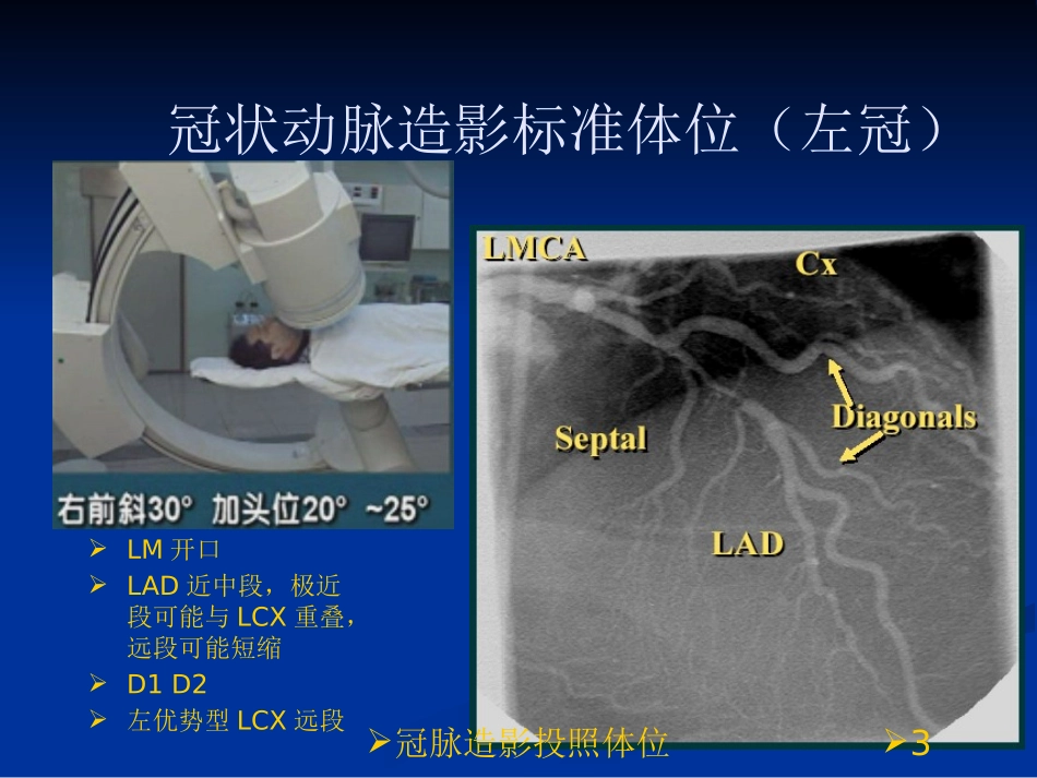 冠脉造影投照体位培训课件.pptx_第3页