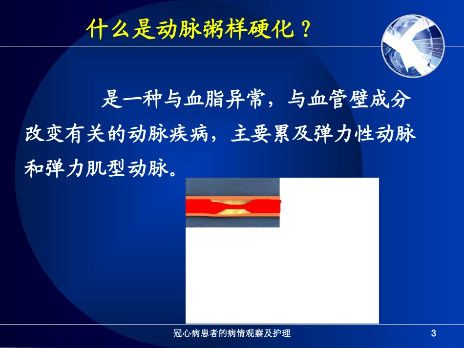 冠心病患者的病情观察及护理培训课件.pptx_第3页