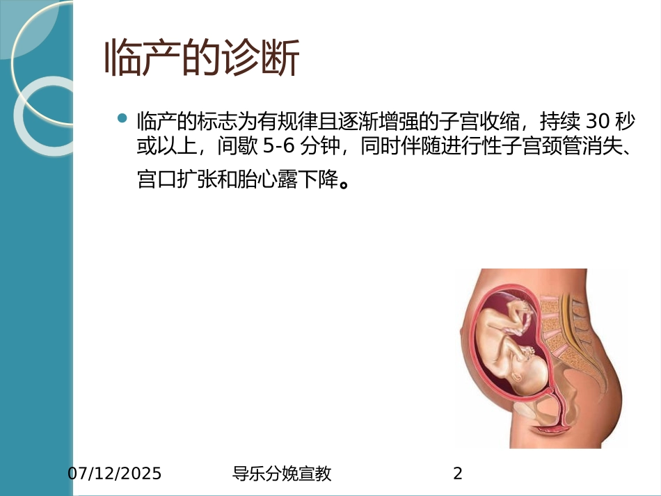 导乐分娩宣教课件.pptx_第2页