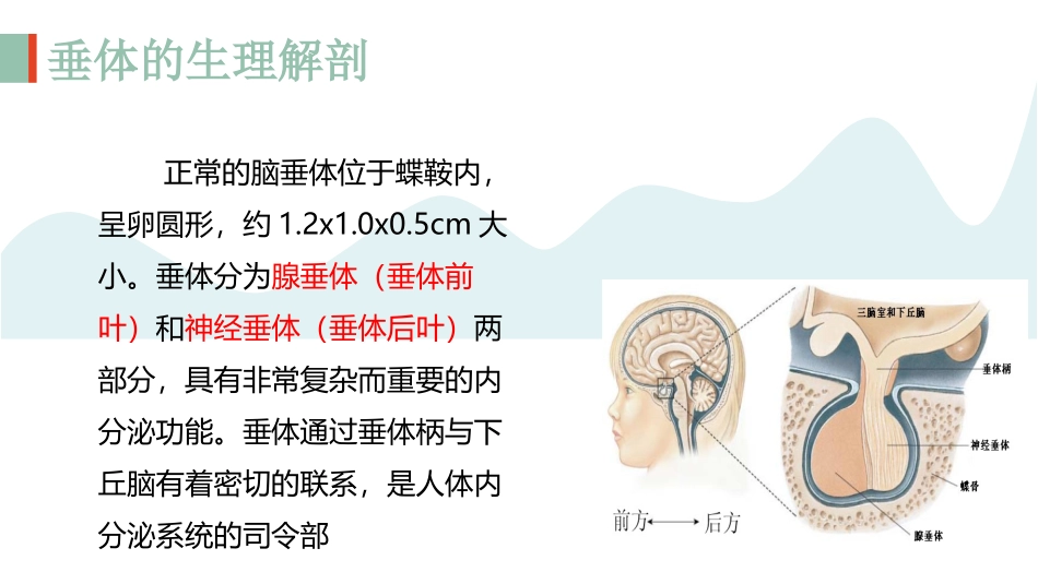 垂体瘤术后护理查房培训课件.pptx_第3页