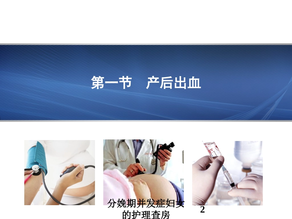 分娩期并发症妇女的护理查房培训课件.pptx_第2页
