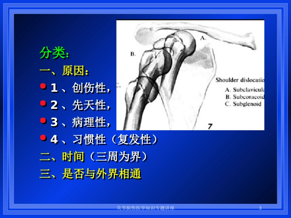 关节损伤医学知识专题讲座培训课件.pptx_第3页
