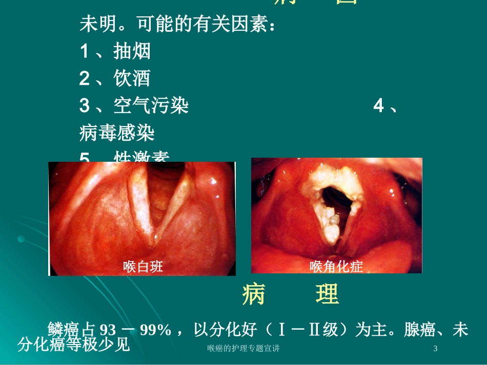 喉癌的护理专题宣讲培训课件.pptx_第3页