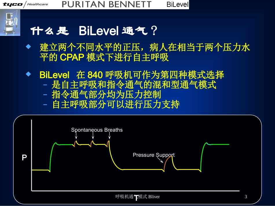 呼吸机通气模式Bliver培训课件.pptx_第3页