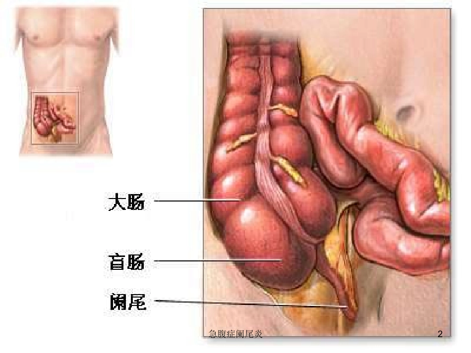急腹症阑尾炎培训课件.pptx_第2页