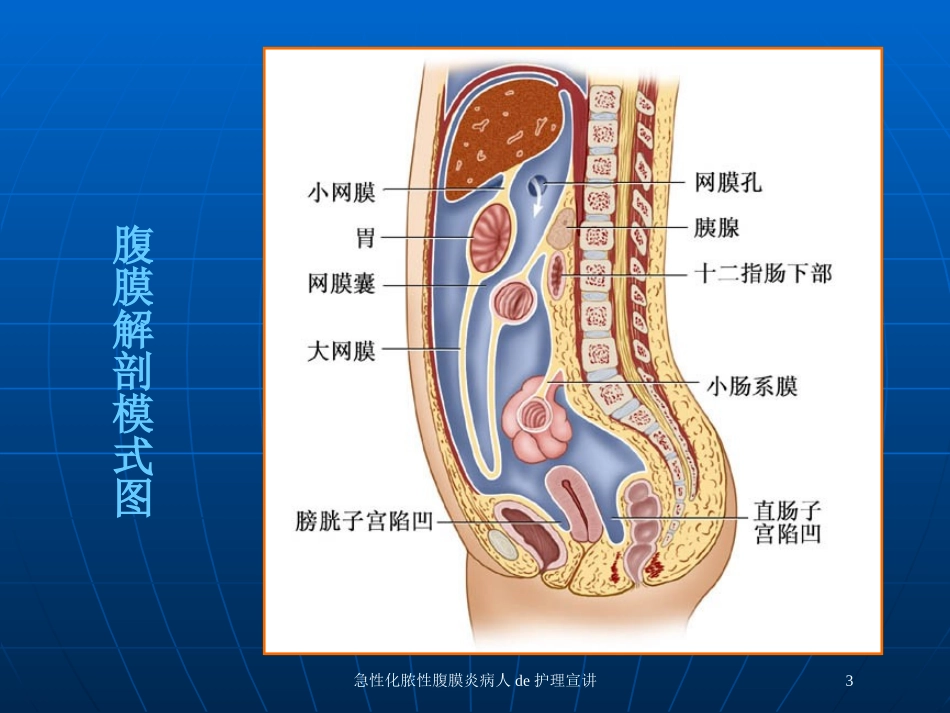 急性化脓性腹膜炎病人的护理宣讲培训课件.pptx_第3页