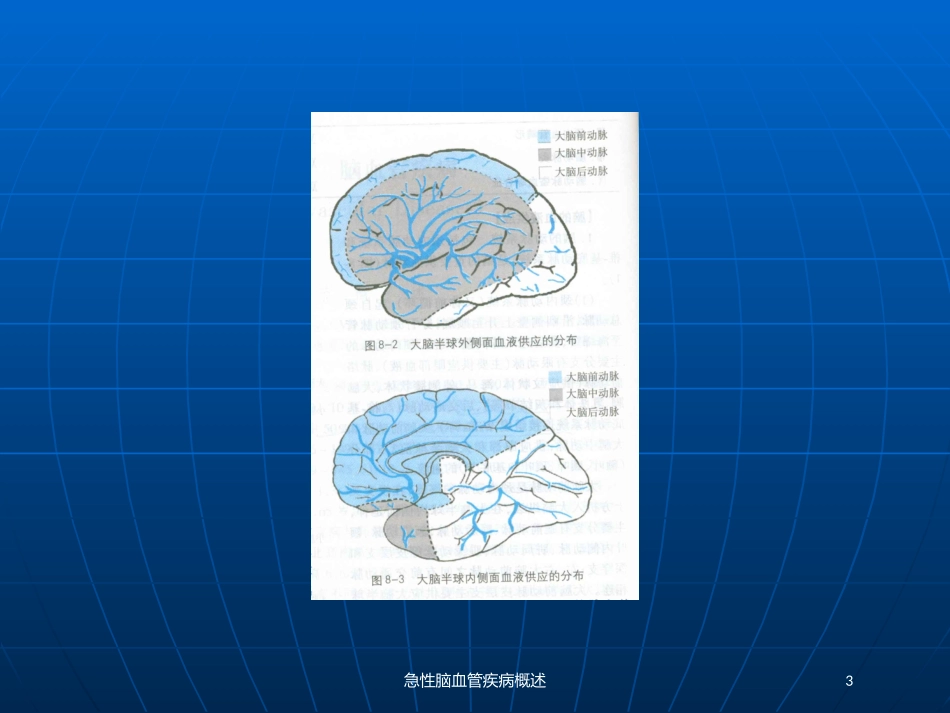 急性脑血管疾病概述培训课件.pptx_第3页