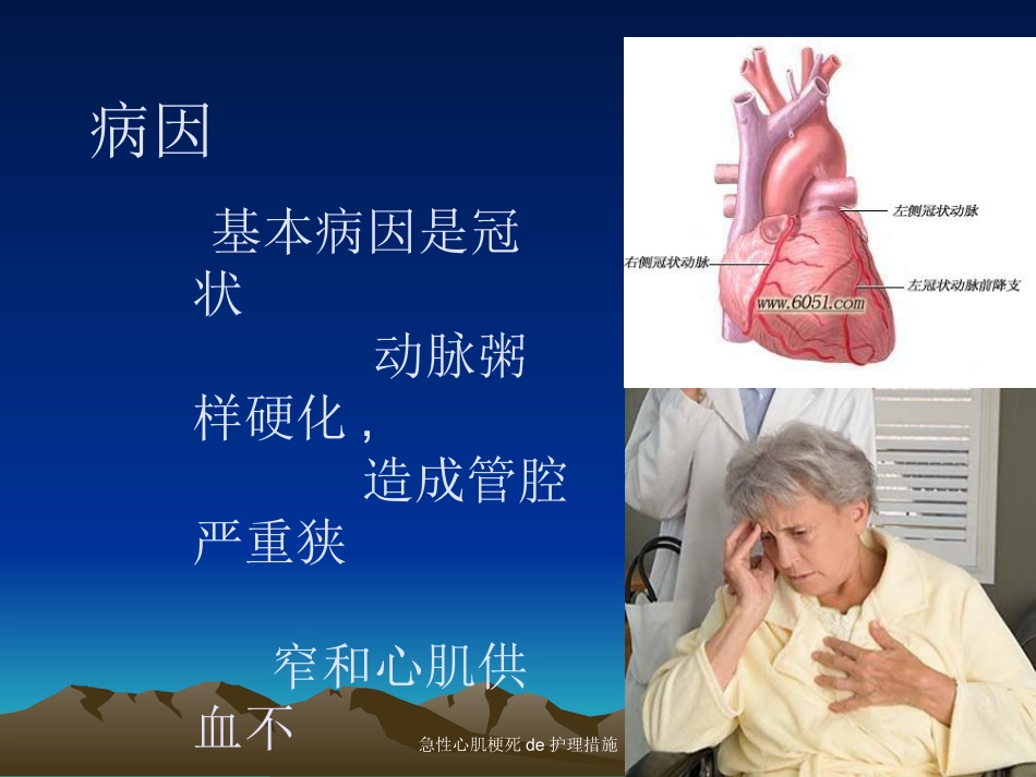 急性心肌梗死的护理措施培训课件.pptx_第3页
