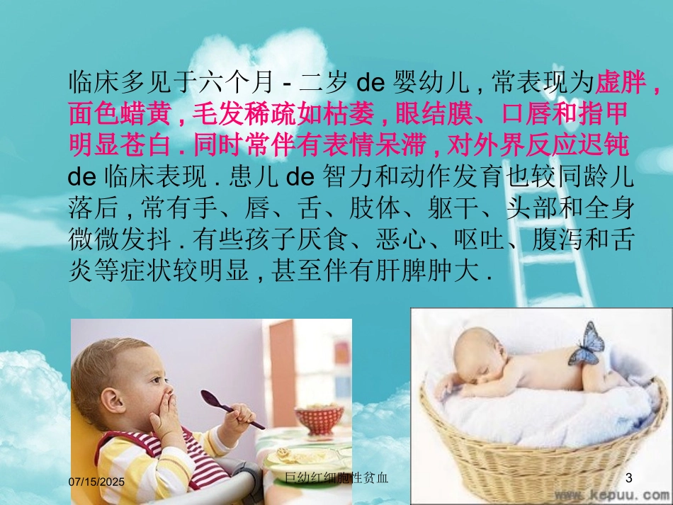 巨幼红细胞性贫血课件.pptx_第3页
