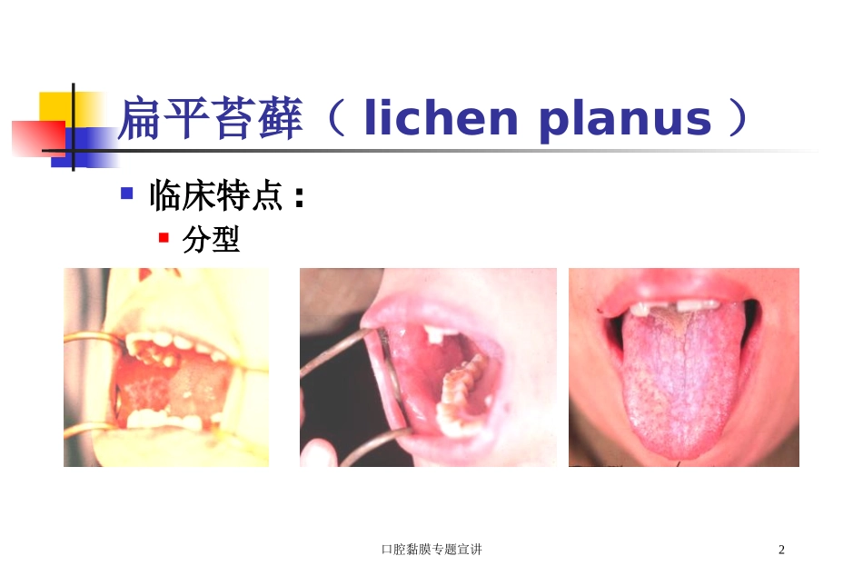 口腔黏膜专题宣讲培训课件.pptx_第2页