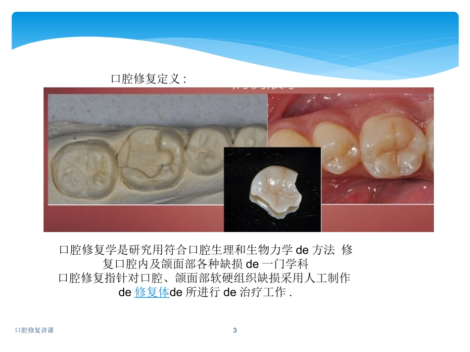 口腔修复讲课培训课件.pptx_第3页