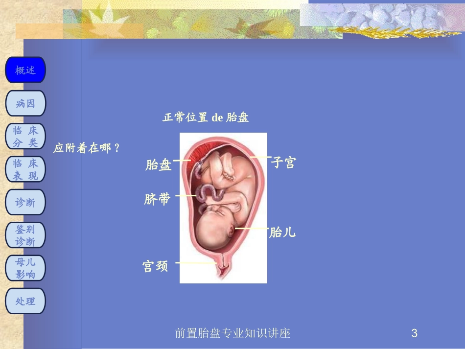 前置胎盘专业知识讲座培训课件.pptx_第3页