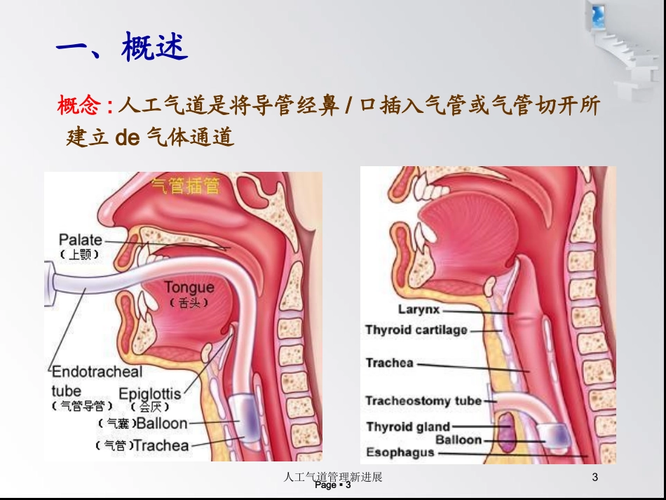 人工气道管理新进展培训课件.pptx_第3页