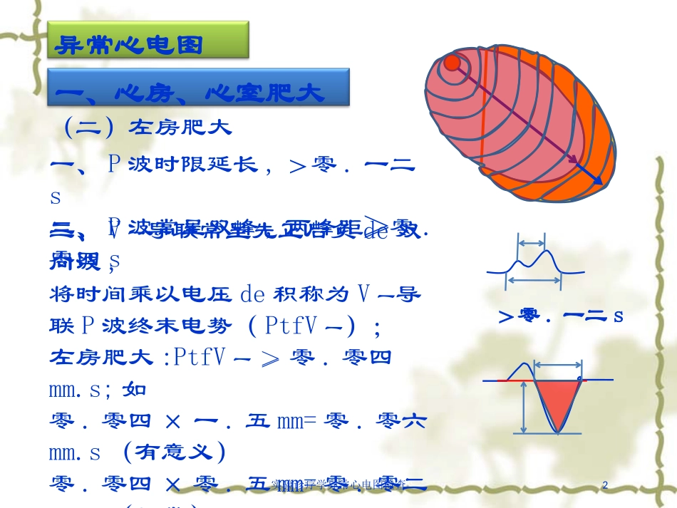 实验诊疗学异常心电图检查培训课件.pptx_第2页