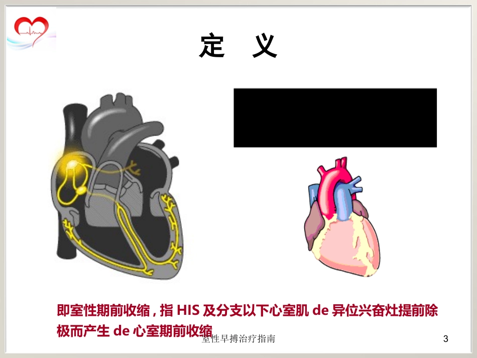 室性早搏治疗指南培训课件.pptx_第3页