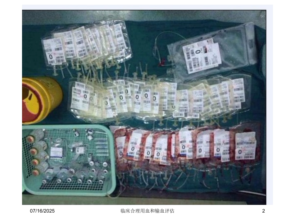 临床合理用血和输血评估培训课件.pptx_第2页
