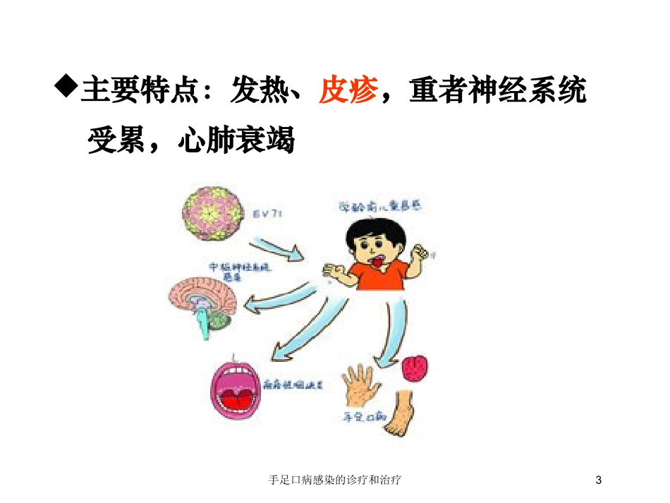 手足口病感染的诊疗和治疗培训课件.pptx_第3页