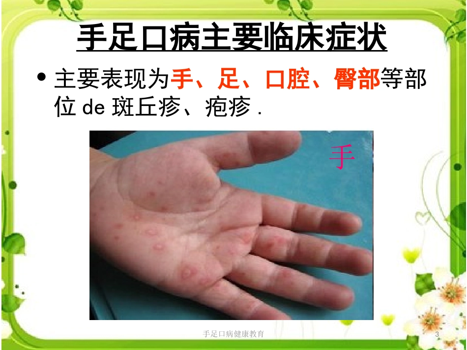 手足口病健康教育培训课件.pptx_第3页