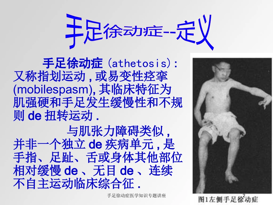 手足徐动症医学知识专题讲座培训课件.pptx_第2页