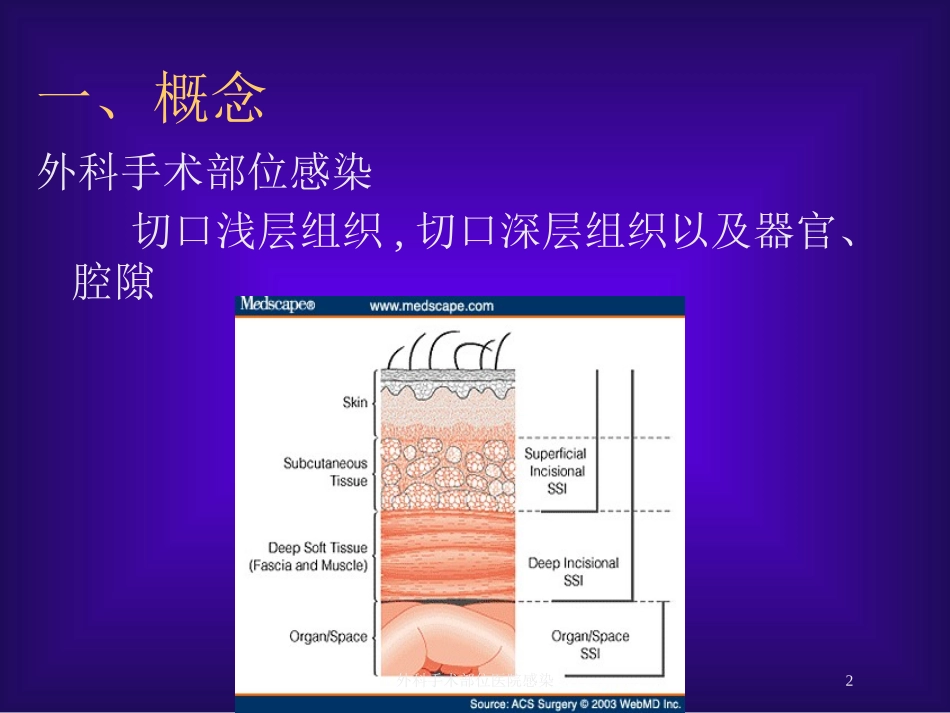 外科手术部位医院感染培训课件.pptx_第2页