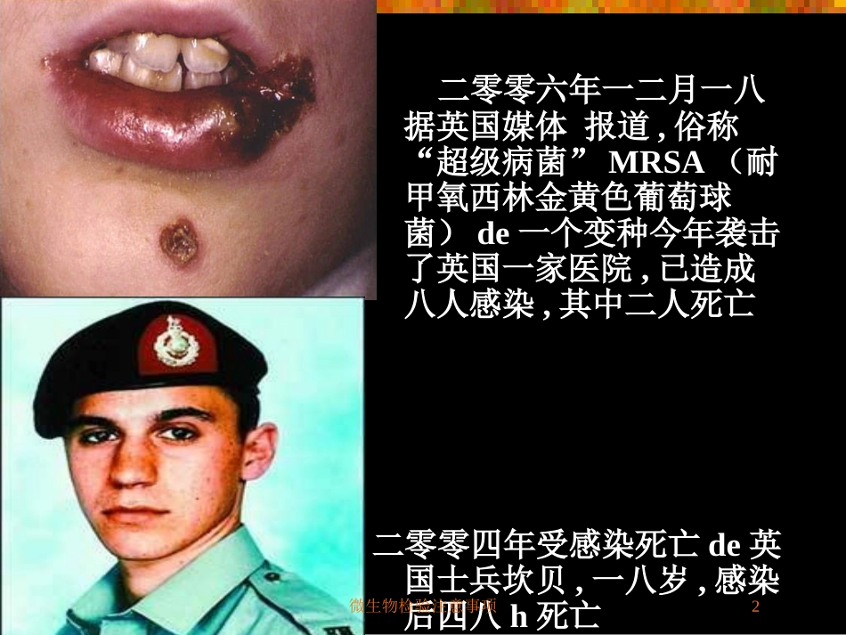 微生物检验注意事项培训课件.pptx_第2页
