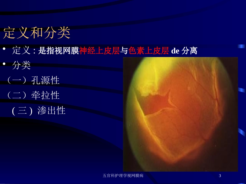 五官科护理学视网膜病培训课件.pptx_第3页