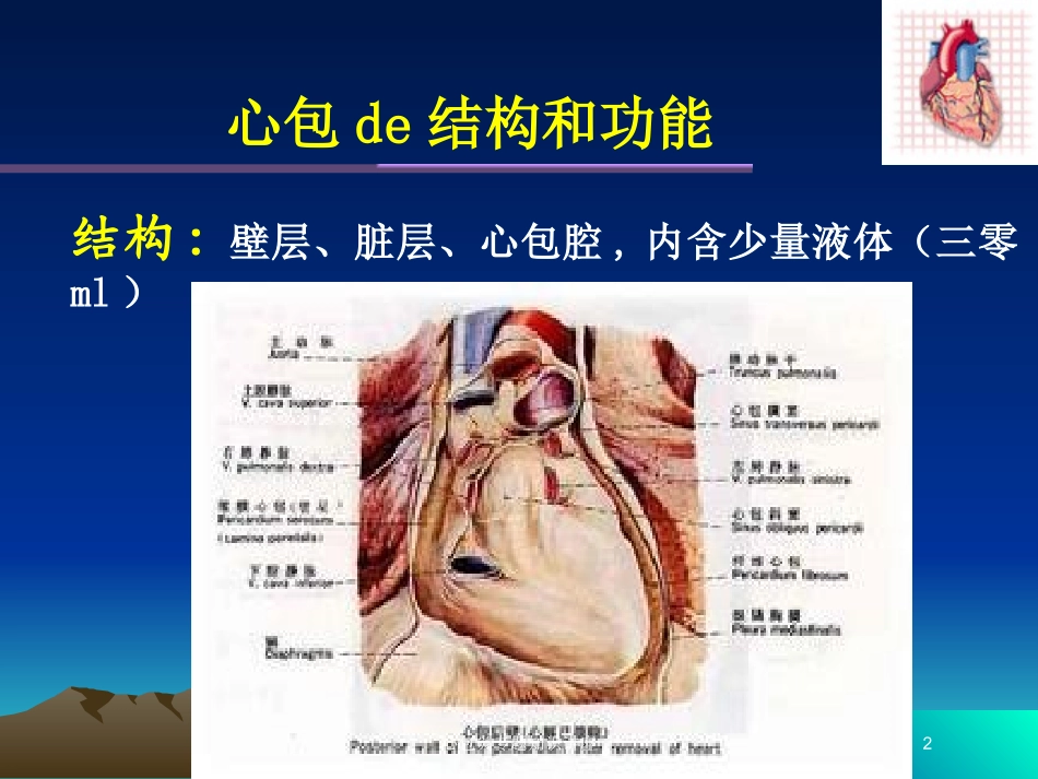 心包炎专题知识讲座培训课件.pptx_第2页