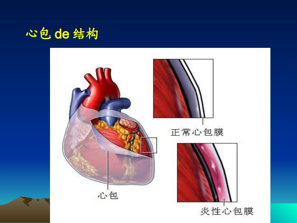 心包炎专题知识讲座培训课件.pptx_第3页