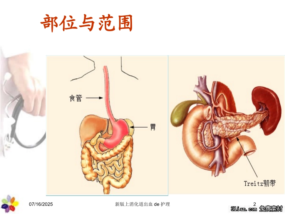 新版上消化道出血的护理培训课件.pptx_第2页