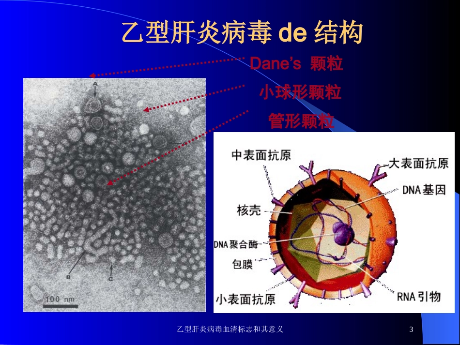 乙型肝炎病毒血清标志和其意义培训课件.pptx_第3页