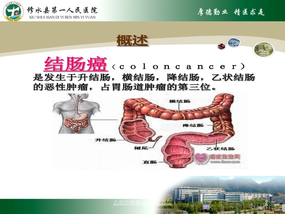 乙状结肠癌的护理查房培训课件.pptx_第2页