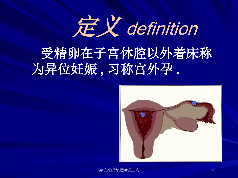 异位妊娠专题知识宣教培训课件.pptx_第2页