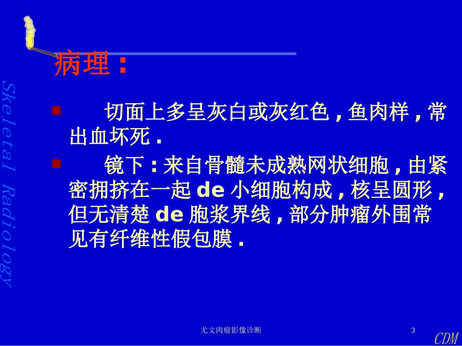 尤文肉瘤影像诊断培训课件.pptx_第3页