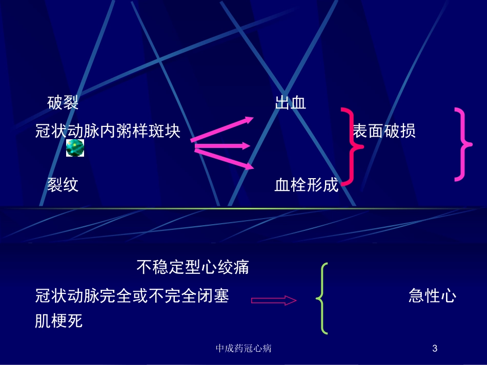 中成药冠心病培训课件.pptx_第3页