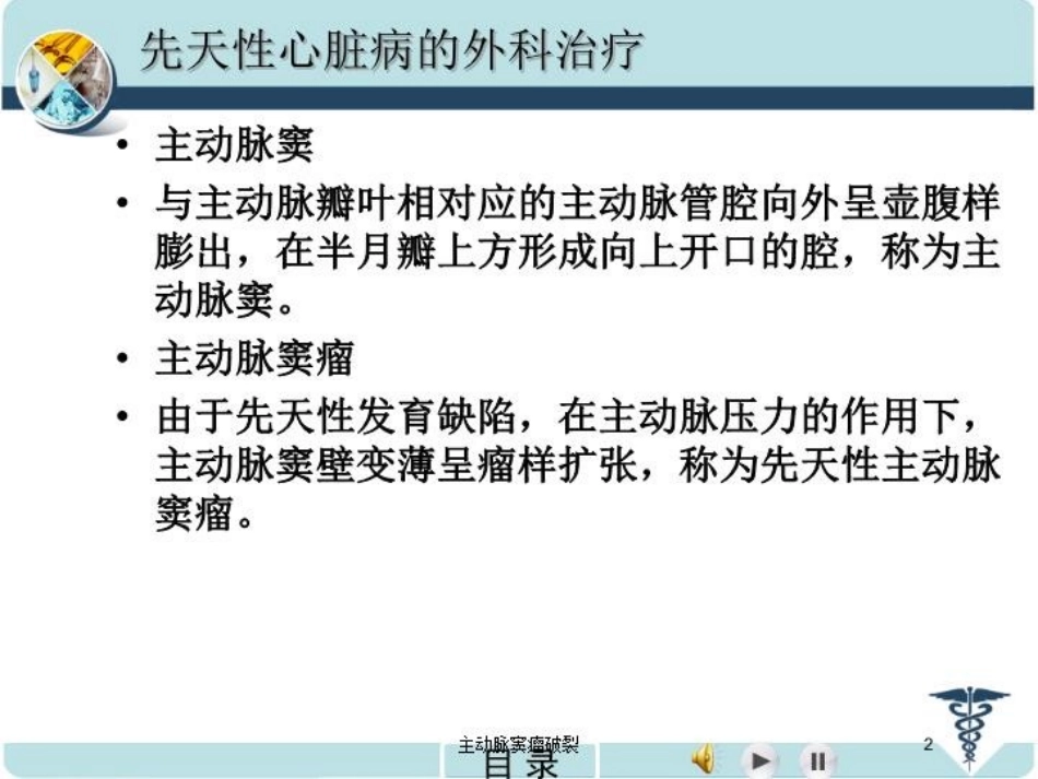 主动脉窦瘤破裂培训课件.pptx_第2页