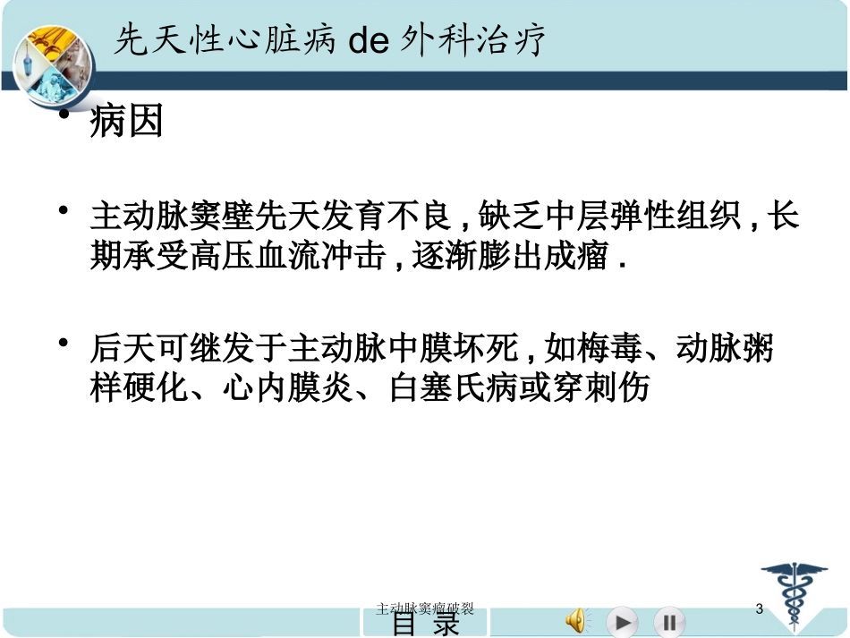 主动脉窦瘤破裂培训课件.pptx_第3页
