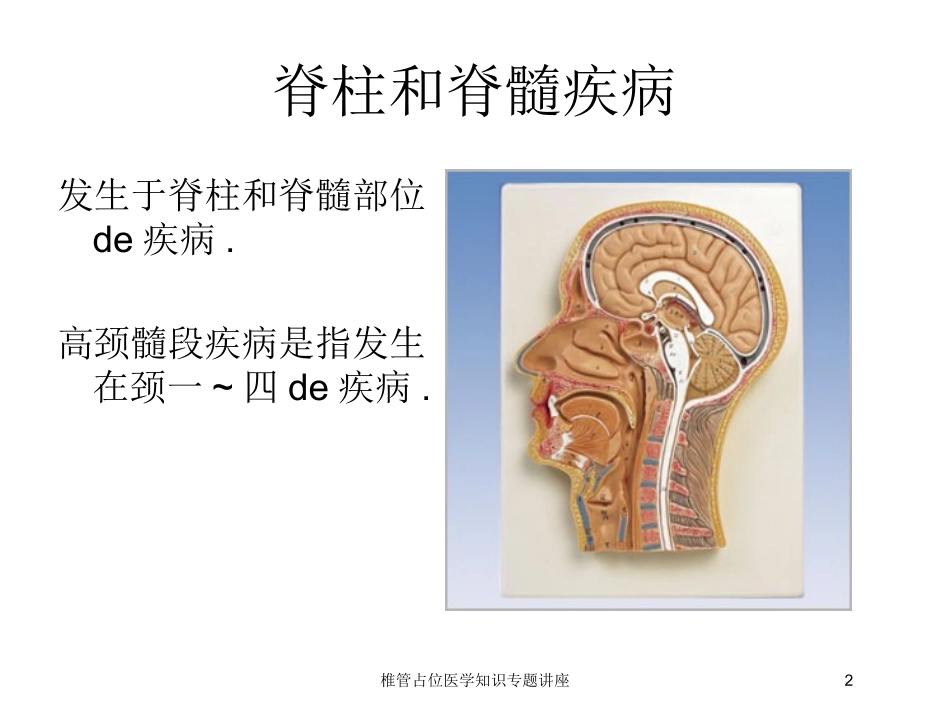 椎管占位医学知识专题讲座培训课件.pptx_第2页