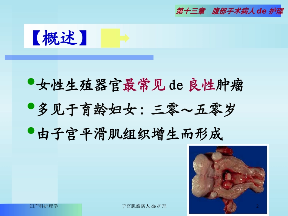 子宫肌瘤病人的护理培训课件.pptx_第2页