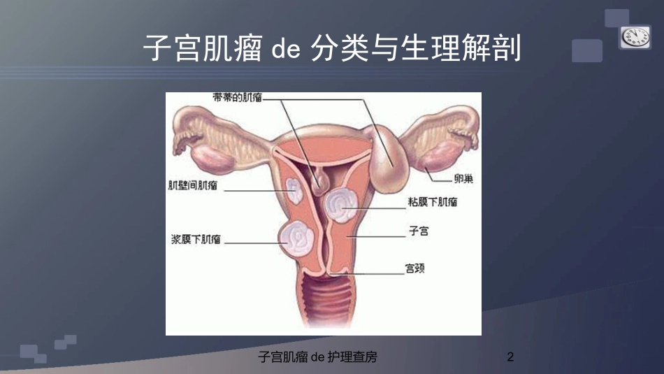 子宫肌瘤的护理查房培训课件.pptx_第2页
