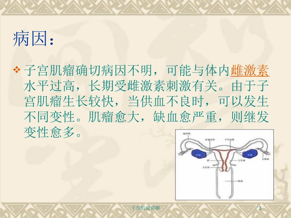 子宫肌瘤讲解培训课件.pptx_第3页